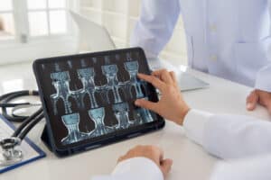 Doctor check up cervical vertebrae spine x-ray image on digital tablet screen with medical team for consult.