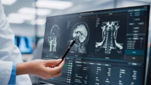 Physicians Look at CT Scan. Close-up
